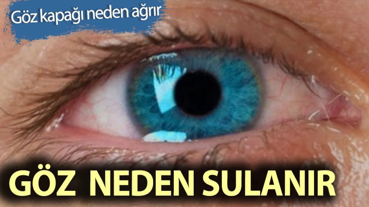 Göz Kapağı Ağrısı ve Göz Sulanması: Nedenleri ve Tedavisi